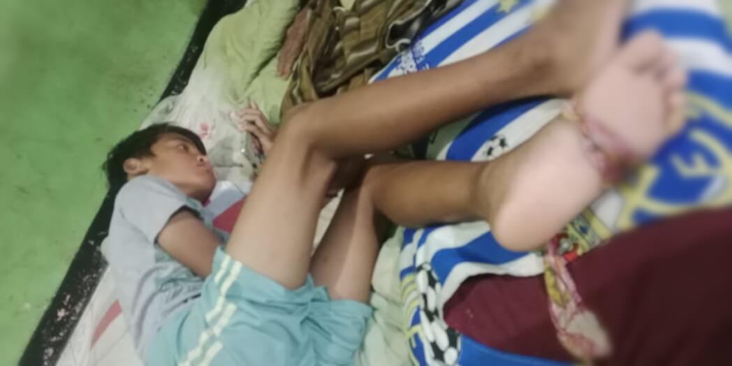 Anak Warga Pulau Tunda Disengat Ikan Beracun, Tenaga Medis Tak Ada di Tempat