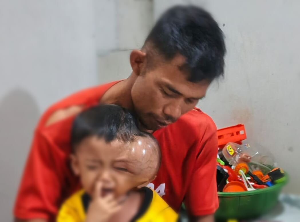 Balita di Pandeglang Derita Tumor Ganas Tak Punya Biaya Untuk Berobat